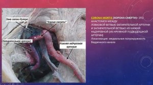 ВНУТРЕННЯЯ ПОДВЗДОШНАЯ АРТЕРИЯ