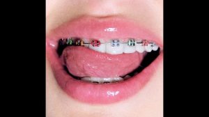 GAVRILINA - Брекеты (1ЧАС)