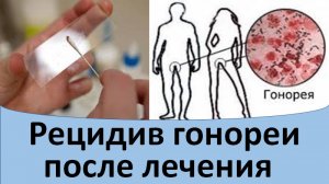 Рецидив гонореи после лечения