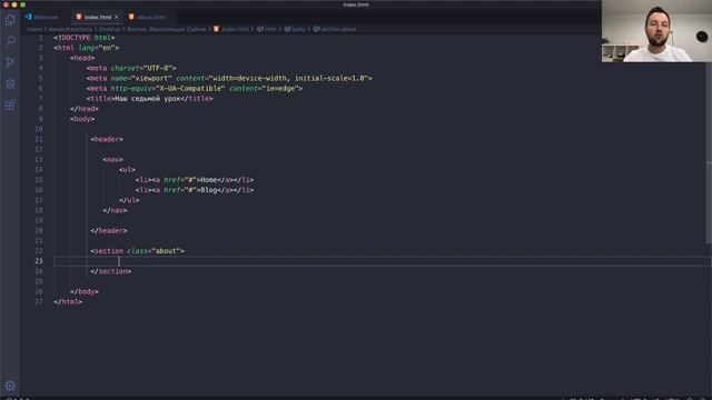 Винтик. Профессия Верстальщик Сайтов. Урок #7 смотреть онлайн