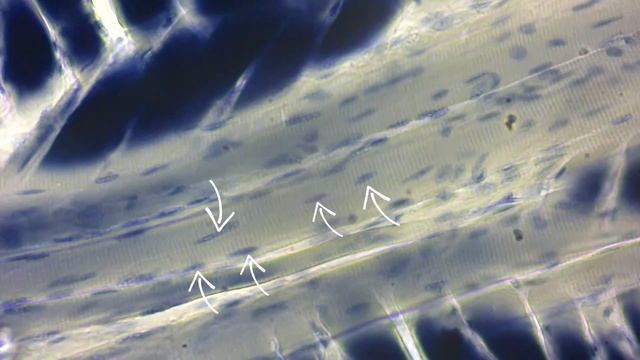 Разбор гистологического препарата: Поперечно-полосатая мышечная ткань смотреть онлайн