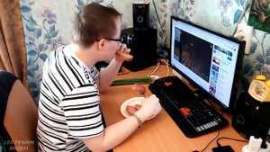 Миопатия Дюшенна. Duchenne Muscular Dystrophy