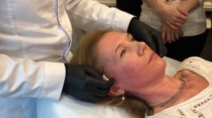 Тредлифтинг. Мезонити и COG Vifiny 8D