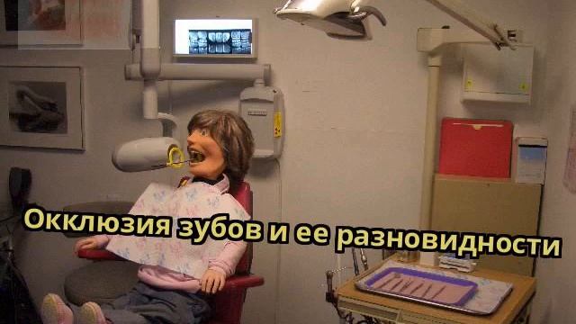 Окклюзия зубов и ее разновидности