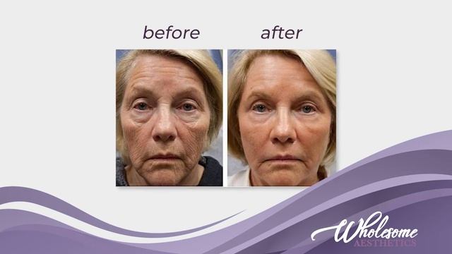 Here’s What You Don’t Know About ClearLift смотреть онлайн