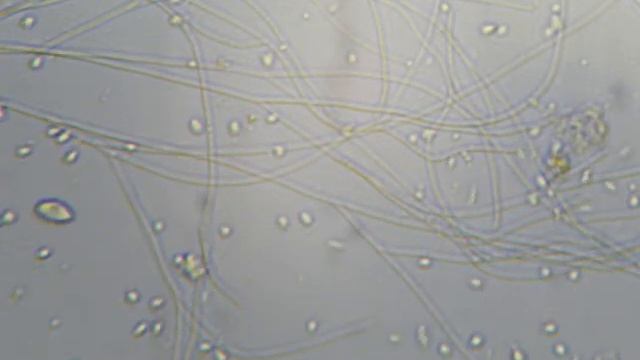 Высыхает капля воды вместе со всеми ее обитателями смотреть онлайн