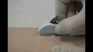 Введение Импланон НКСТ 3 шага