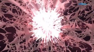 Смас лифтинг Лифтера