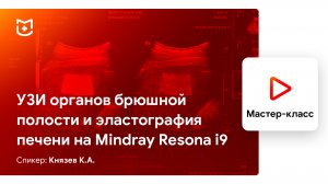 УЗИ органов брюшной полости и эластография печени на Mindray Resona i9