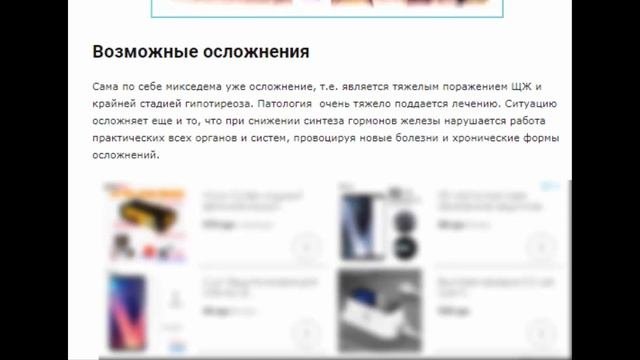 Микседема - как проходит лечение, основные способы диагностики и профилактики