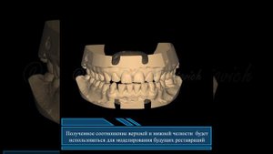 #Стираемость Зубов, как всё восстановить?!
