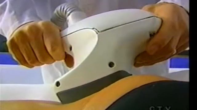 Foto Facial IPL Laser Skin Treatment Demonstration on CTV | SpaMedicaTV смотреть онлайн