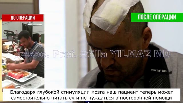 Хирургия Глубокой Стимуляции Мозга
