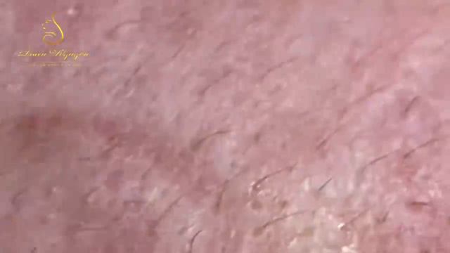 Relax Every Day With Loan Nguyen Spa TV #1048 смотреть онлайн