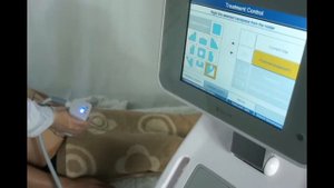 Liposonix HIFU. Проведение процедуры