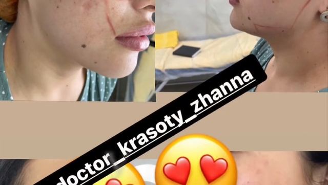 Врач-косметолог Шымкент смотреть онлайн