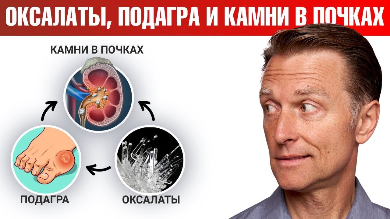Профилактика камней в почках. Берг почки. Голодание при камнях в желчном. Берг почки. Берг почки.