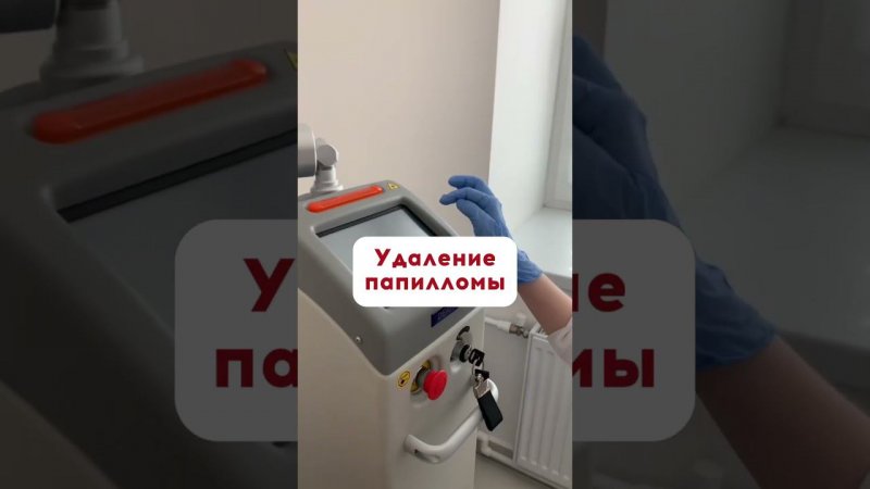 Удаление папилломы. Запись в ватсап + 7 931 244 00 44