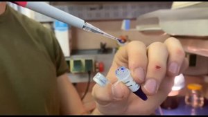 Электрофорез ДНК в агарозном геле.