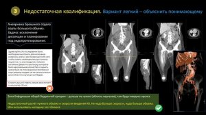 Ошибки в работе рентгенолаборанта. Взгляд со стороны рентгенолога на "удаленке".