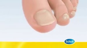 Fungal Nail Condition by Scholl