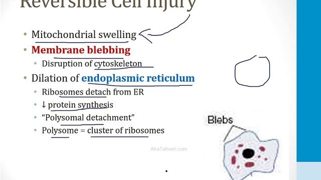 Патология USMLE - 1. Общие темы - 2.Повреждение Клеток