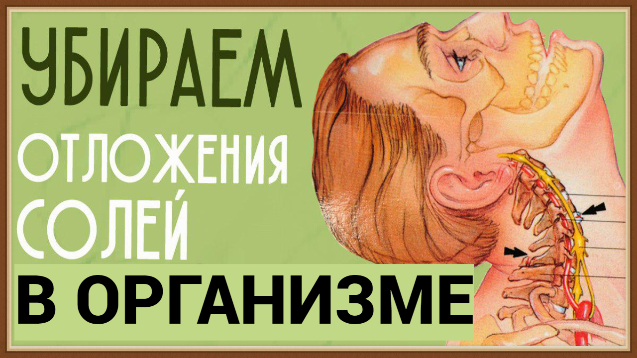 ОЧИЩЕНИЕ ОРГАНИЗМА ОТ СОЛЕЙ