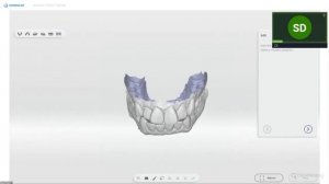 Shining3D Aoralscan 3 (Wireless)  Basic Training Webinar Part 2