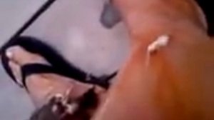 Песчаные блохи.укусы.