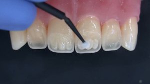 Мамелоны. Часть 1. Моделирование 3-х мамелонов