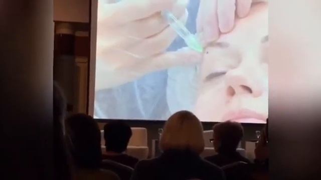 Мастер-класс. Авторские методики работы с кожей периорбитальный области. Абдушукурова М.М.