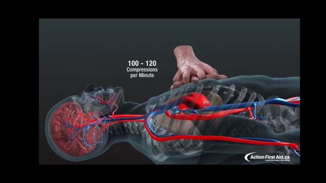 СЛР|3D взгляд на процесс|Реанимация #здоровье #медицина #скорая #реанимация #жизнь #ambulance #fyp