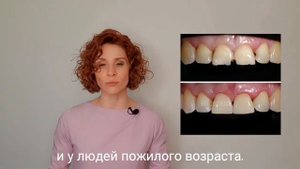 Почему световые пломбы лучше?