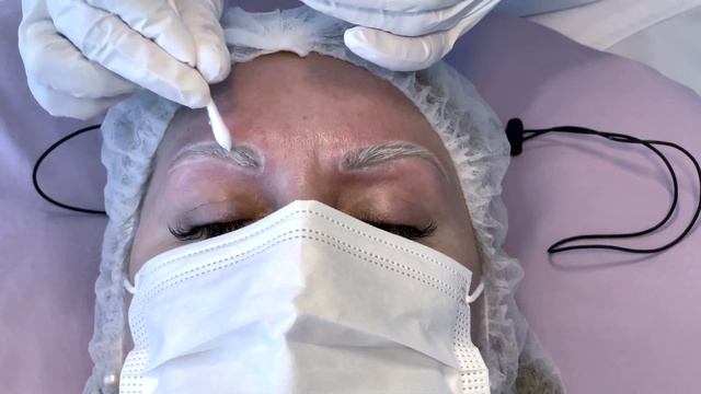 Laser Tattoo Removal. Eyebrows (My experience, full treatment, healing process) смотреть онлайн