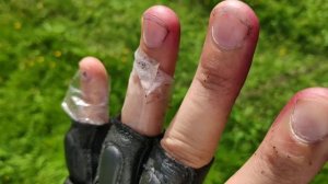 Как собирать ежевику и облепиху и не царапать руки