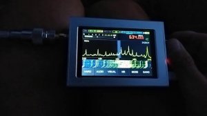 СВ Китайский "Малахит" с магнитной антенной