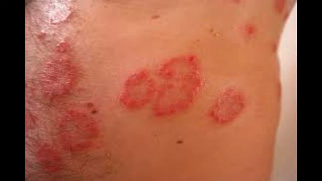 IT PREVENTS AND CURES ALMOST ALL DISEASES STEVIA A MAGICAL GIFT FROM NATURE смотреть онлайн