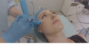 How to Mark-up 4 points for Ejal 40-Automatic translated from Russian to English.