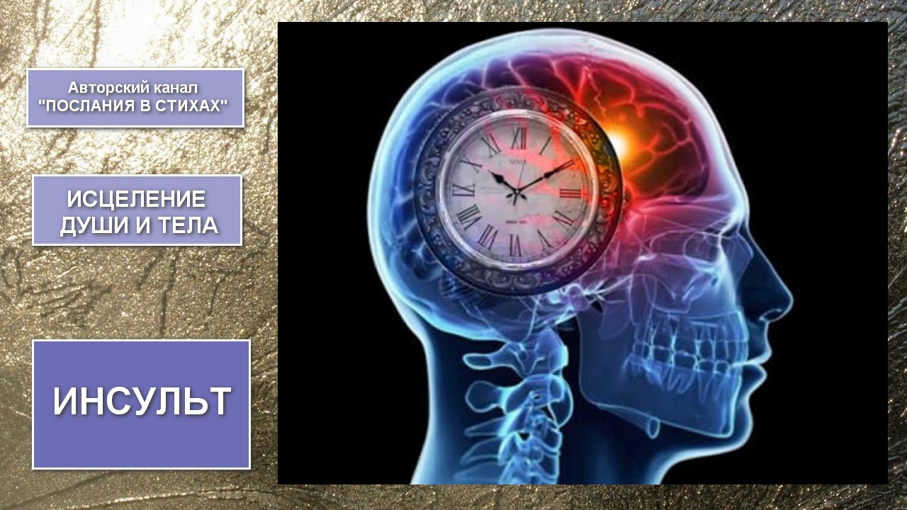 Stroke 1. Расстройства мозгового кровообращения. Инсульт картинки.