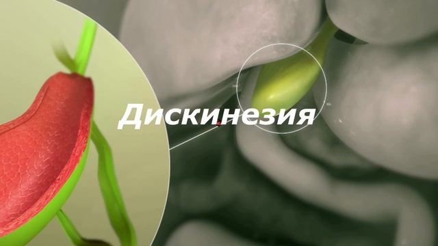 ЛЕЧЕНИЕ ЗАБОЛЕВАНИЙ ЖЕЛЕЧНОГО ПУЗЫРЯ И ЕГО ПРОТОКОВ. ЗДОРОВАЯ ЖИЗНЬ.