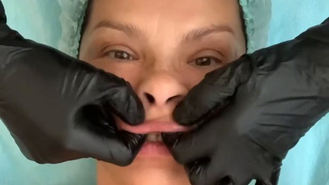 Буккальный глубокотканный массаж лица