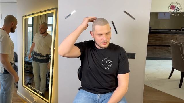 Кейс: очаговая алопеция надолго скрыта. Трихопигментация мастер Афанасьев. Scalp Micropigmentation.