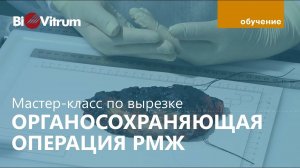 Вырезка: ОСО при РМЖ