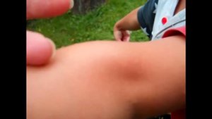 Квакша обыкновенная