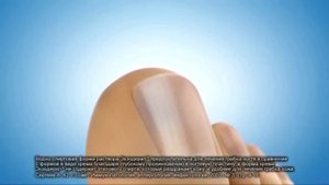 (2016) Экзодерил - 40 лет опыта борьбы с грибком