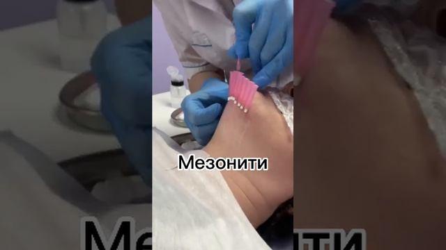 Мезонити