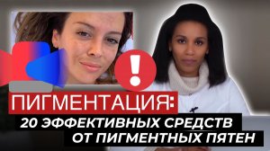 ПИГМЕНТАЦИЯ!!! Как осветлить пигментные пятна// Лучшие средства от пигментации