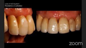 Livestream von Master of Oral Implantology