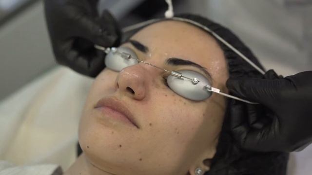 Лазерное омоложение на аппарате Cynosure Elite+ в клинике "Оливия" смотреть онлайн