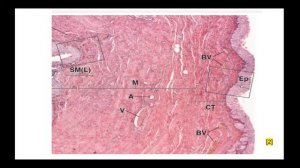 Гистологическое строение стенки мочевого пузыря. Препарат: Мочевой пузырь (г-э).